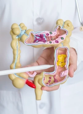 Diverticulitis Laparoscópica en Mérida