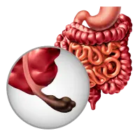 Cirujano Gastroenterólogo en Mérida