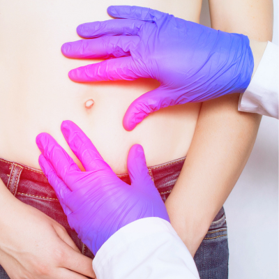 hernias merida